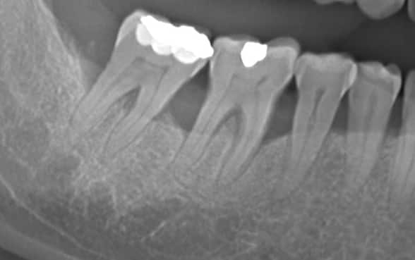 Çankaya Ankara'da Flap Operasyonu